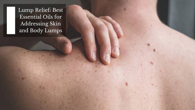 Lump Relief: Best Essential Oils for Addressing Skin and Body Lumps