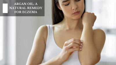 Argan Oil: A Natural Remedy For Eczema