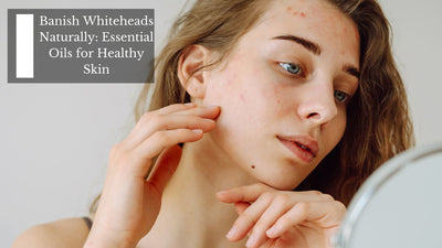 Banish Whiteheads Naturally: Essential Oils for Healthy Skin
