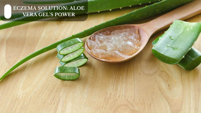 Eczema Solution: Aloe Vera Gel's Power