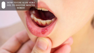 How To Use Aloe Vera Gel To Soothe Mouth Sores?
