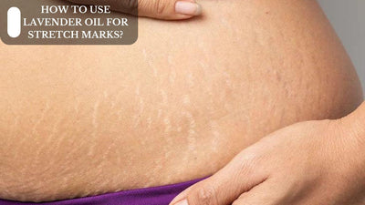 How To Use Lavender Oil For Stretch Marks?