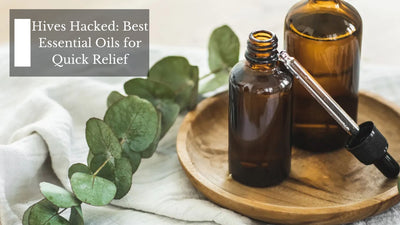Hives Hacked: Best Essential Oils for Quick Relief