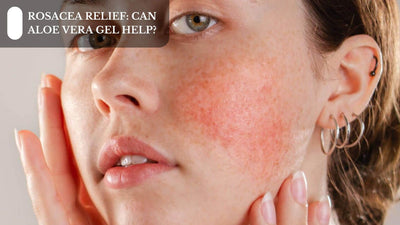 Rosacea Relief: Can Aloe Vera Gel Help?