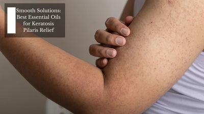 Smooth Solutions: Best Essential Oils for Keratosis Pilaris Relief
