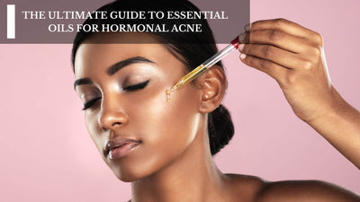 The Ultimate Guide To Essential Oils For Hormonal Acne