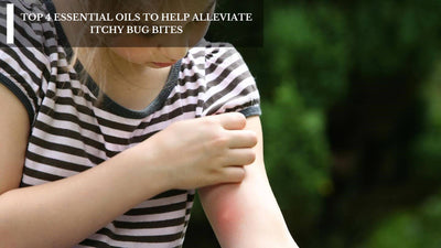 Top 4 Essential Oils To Help Alleviate Itchy Bug Bites