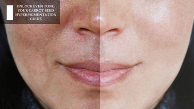 Unlock Even Tone: Your Carrot Seed Hyperpigmentation Guide