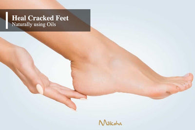 Heal Cracked Feet Naturally using Essential oils